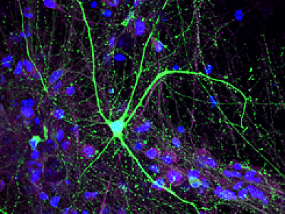 Characterization of neuropsychiatric disease phenotypes of 16p11.2 iPSC derived dopaminergic neurons and cortical neurons in vitro