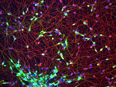 Investigating the mechanism of FMRP dysregulation with loss of TSC2.