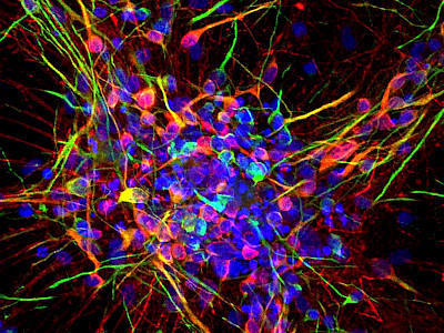 Investigating human-specific changes that occur during early neuron development with loss of TSC2 or CDKL5