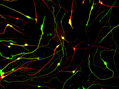 Understanding the molecular mechanisms underlying CNS dysfunctions