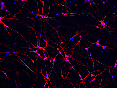 The role of DEPDC5 in epileptogenesis and brain malformations